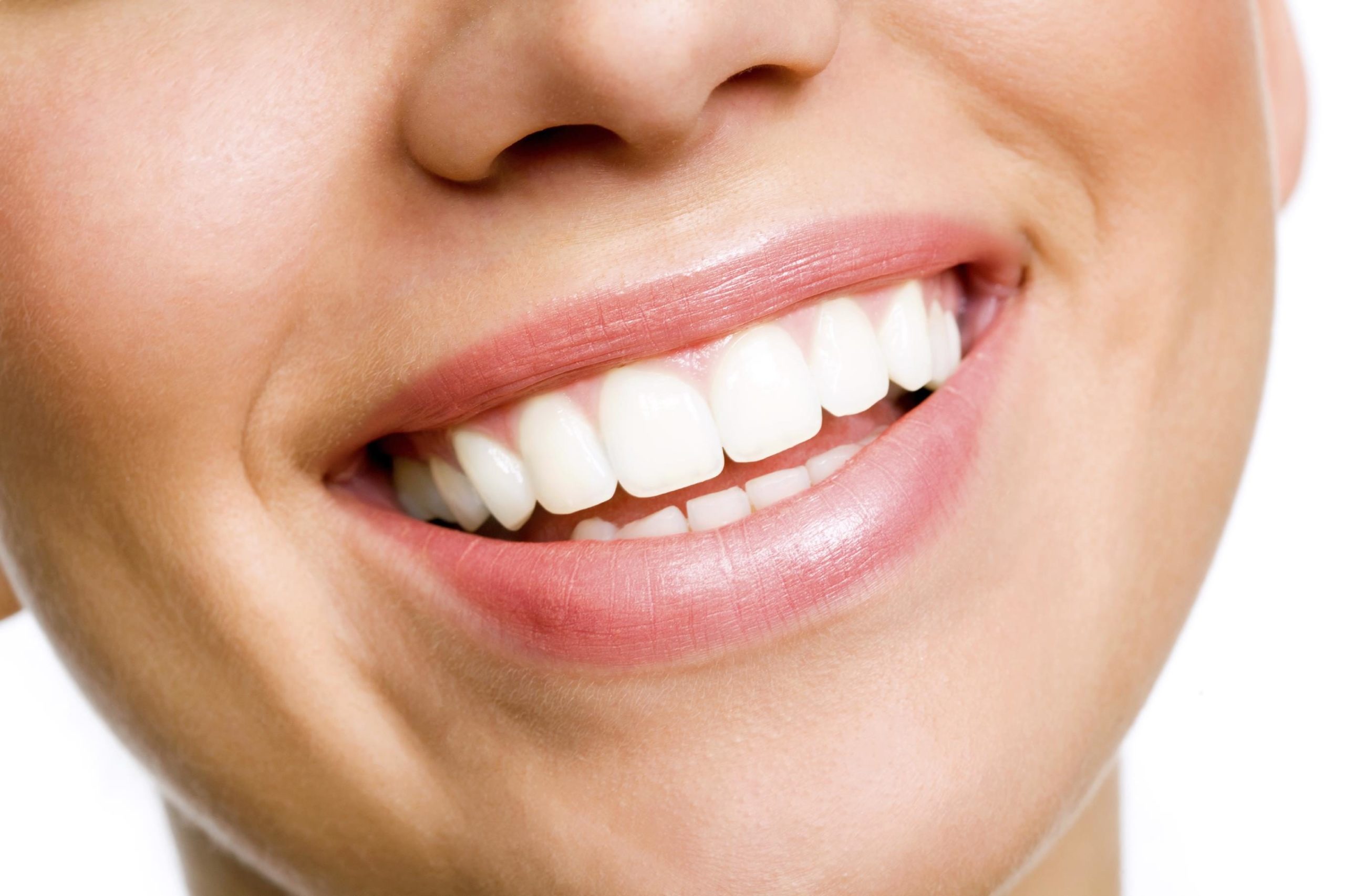 Dental Veneers Sydney | Natural-Looking Smile Makeovers