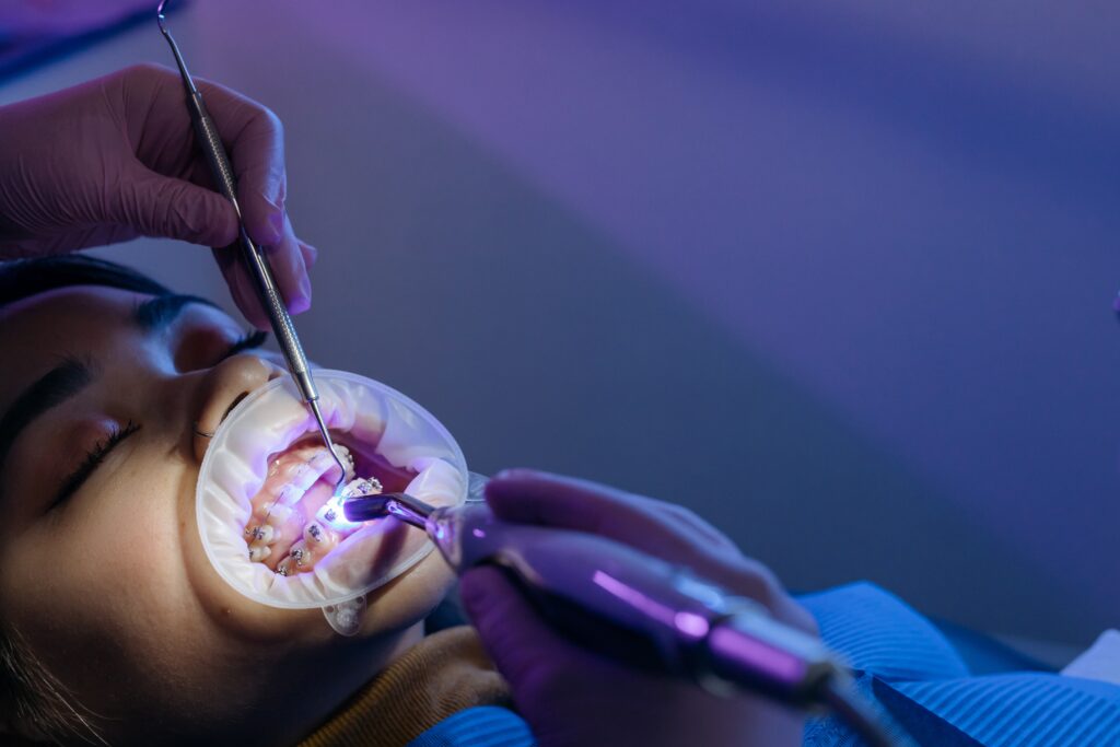 intra oral mucosal scan