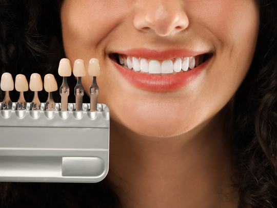 Expert Dental Veneers