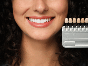 Porcelain Veneers